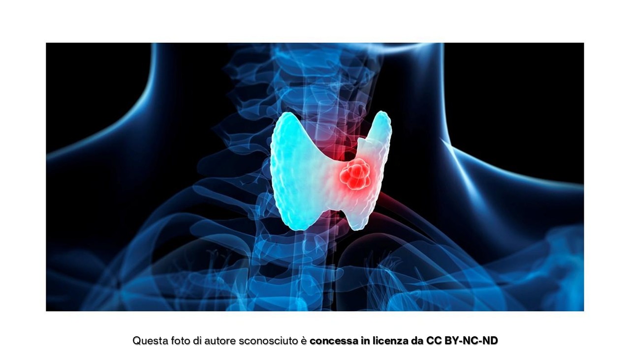 Composizione corporea e tiroide